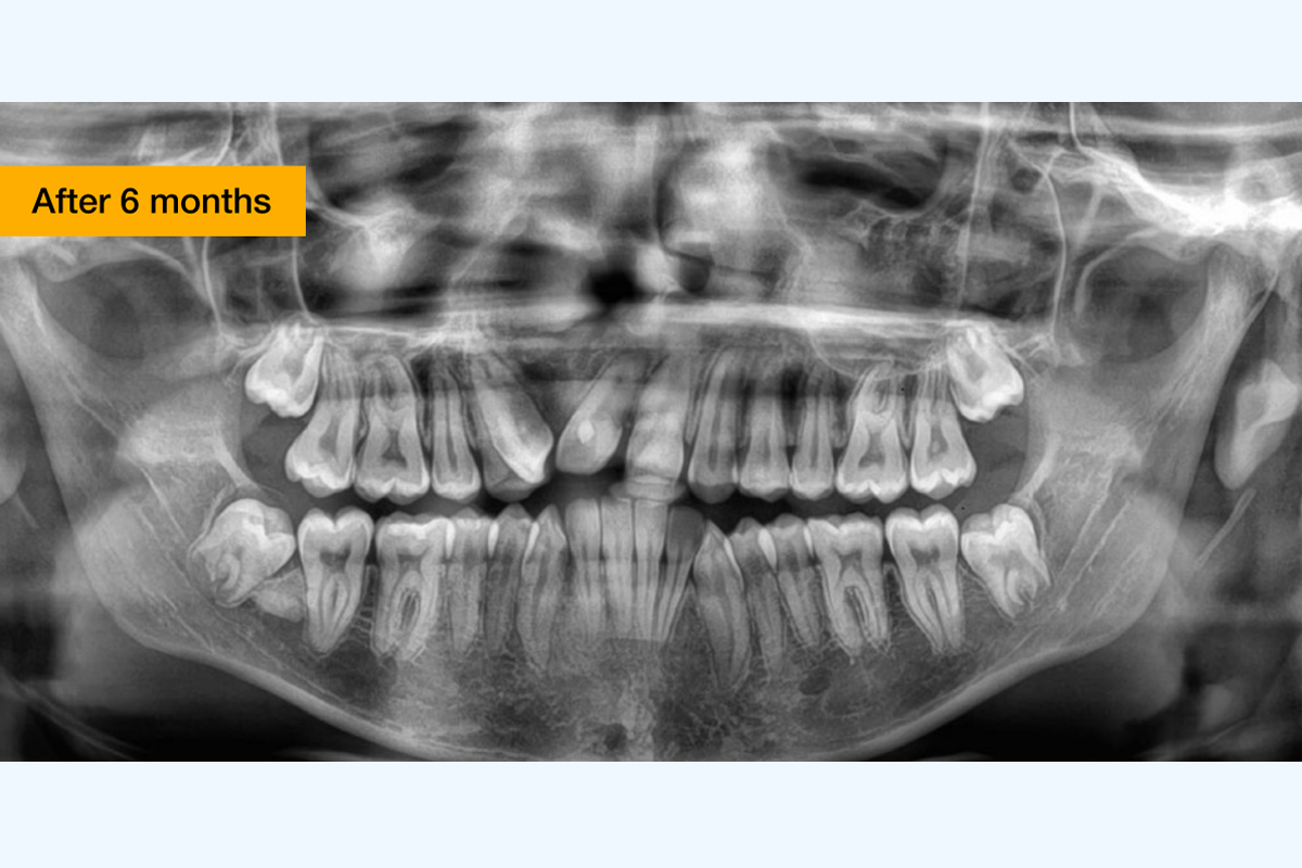 Dental Services at Kalki