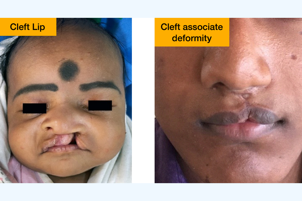 Dental Services at Kalki