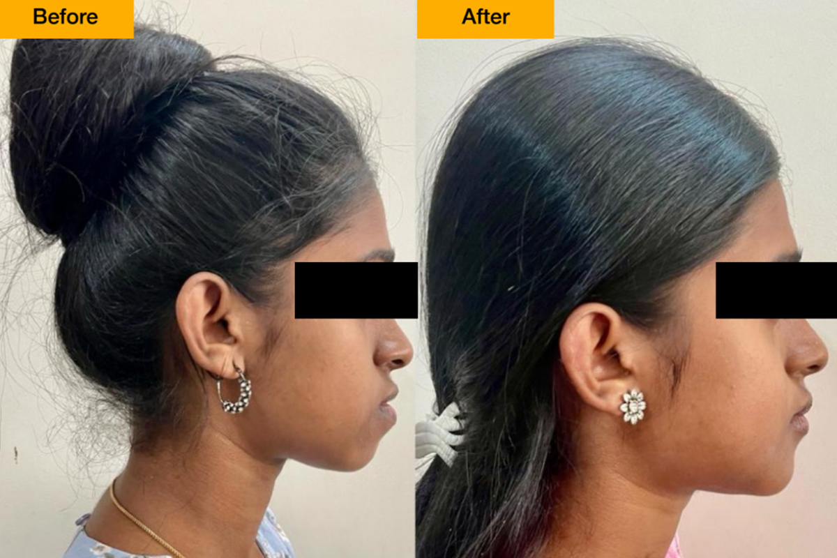 Cosmetic Dentistry