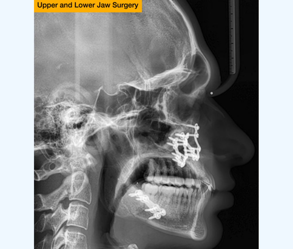 Dental Services at Kalki