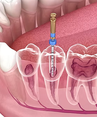 Cosmetic Dentistry