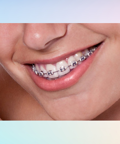 Cosmetic Dentistry
