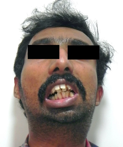 Cosmetic Dentistry